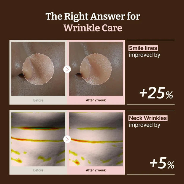 Advanced PDRN Rejuvenating Mask (4ea)