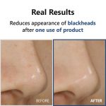 ISNTREE Hyper Acid4 AHA BHA PHA LHA 30 Serum